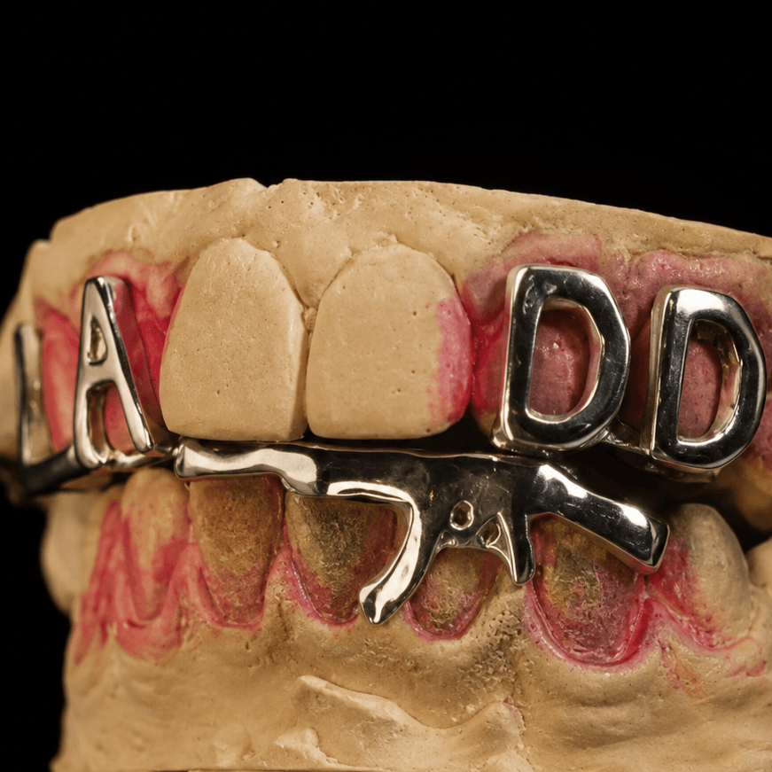 Custom Design · 8 denti — grillz su misura fatto a mano nelle Marche, Grillz Marche
