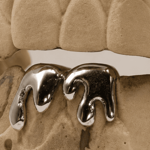 Melted Design · 2 denti — grillz su misura fatto a mano nelle Marche, Grillz Marche