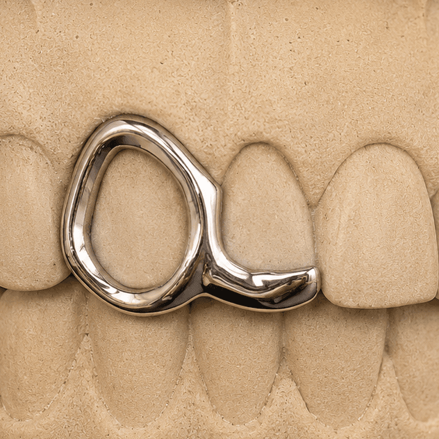 Open Face · 2 denti — grillz su misura fatto a mano nelle Marche, Grillz Marche
